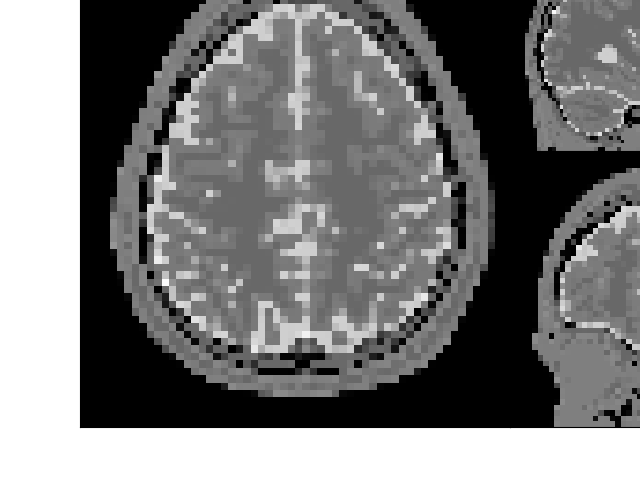 example anat EPI